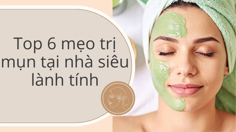 Top 6 mẹo trị mụn tại nhà siêu lành tính, không lo bắt nắng