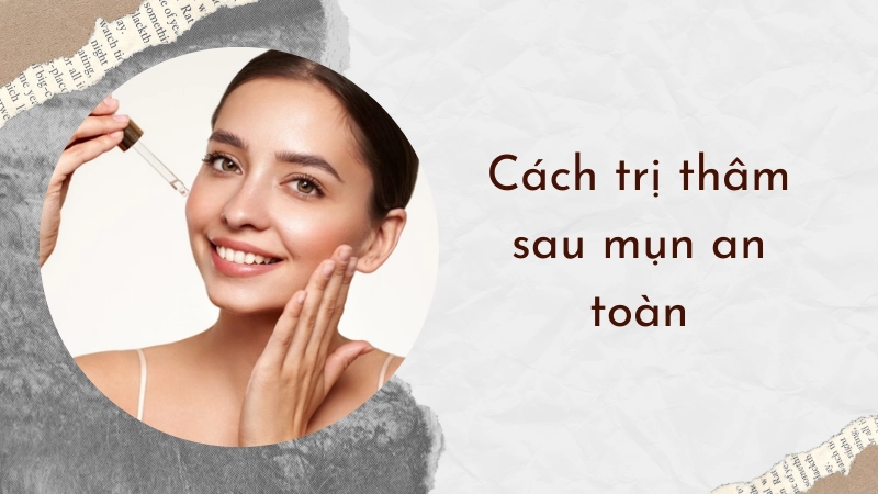 Sử dụng hoạt chất đúng cách là cách trị thâm sau mụn an toàn