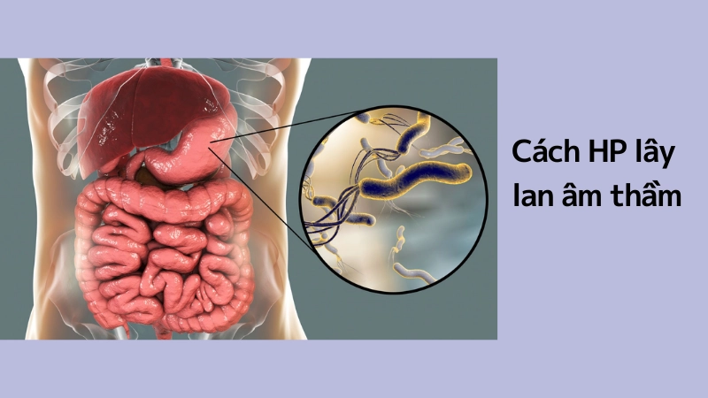 Cơ chế lây lan âm thầm của vi khuẩn HP 